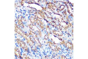 Immunohistochemistry of paraffin-embedded rat kidney using Bcl-XL Rabbit pAb (ABIN3020685, ABIN3020686, ABIN1512625 and ABIN6213668) at dilution of 1:100 (40x lens). (BCL2L1 antibody  (AA 1-120))