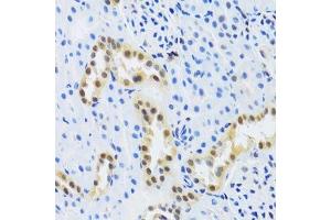 Immunohistochemistry of paraffin-embedded mouse kidney using DDB1 Antibody. (DDB1 antibody)