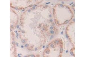 Figure. (Destrin antibody  (AA 1-165))