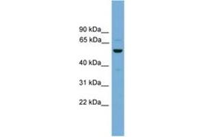 Image no. 1 for anti-Ankyrin Repeat, SAM and Basic Leucine Zipper Domain Containing 1 (ASZ1) (AA 215-264) antibody (ABIN6744976) (ASZ1 antibody  (AA 215-264))