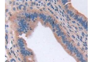 Immunohistochemistry (IHC) image for anti-HLA-DR-gamma (CD74) (AA 64-205) antibody (ABIN7443722)
