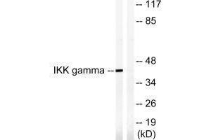 Western blot analysis of extracts from HepG2 cells, treated with Anisomycin (0. (IKBKG antibody  (Ser85))