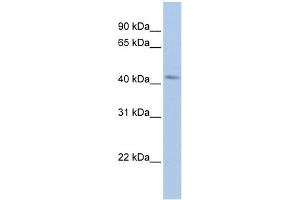 WB Suggested Anti-BARHL2 Antibody Titration:  0. (BARHL2 antibody  (Middle Region))