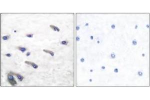 Immunohistochemistry analysis of paraffin-embedded human brain, using PDGF Receptor beta (Phospho-Tyr751) Antibody. (PDGFRB antibody  (pTyr751))