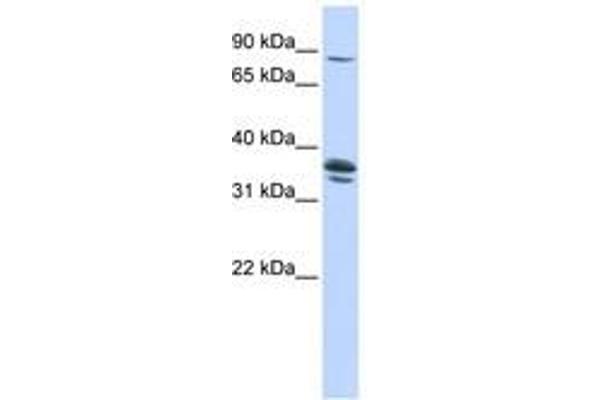 Solute Carrier Organic Anion Transporter Family, Member 3A1 (SLCO3A1) (AA 360-409) anticorps