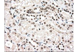 Image no. 3 for anti-TYRO3 Protein Tyrosine Kinase (TYRO3) antibody (ABIN1501605)