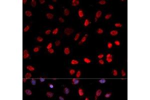 Immunofluorescence analysis of MCF-7 cells using Phospho-ATF2(T71) Polyclonal Antibody (ATF2 antibody  (pThr71))