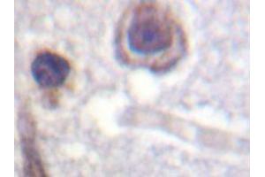 Immunohistochemistry analyzes of CaR antibody in paraffin-embedded human brain tissue. (CASR antibody)