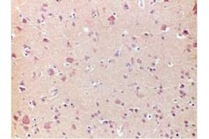 Immunohistochemistry (IHC) image for anti-Frataxin (FXN) antibody (ABIN781667) (Frataxin antibody)