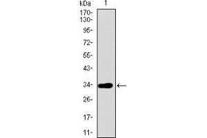 Western blot analysis using ABCG5 mAb against human ABCG5 recombinant protein. (ABCG5 antibody  (AA 306-367))