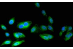 Immunofluorescent analysis of Hela cells using ABIN7145576 at dilution of 1:100 and Alexa Fluor 488-congugated AffiniPure Goat Anti-Rabbit IgG(H+L) (ATIC antibody  (AA 301-592))