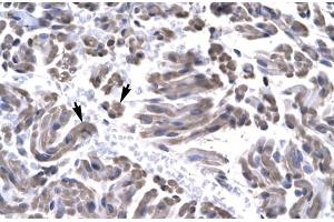 Human Muscle (GTF2H3 antibody  (N-Term))
