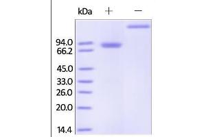 SDS-PAGE (SDS) image for Tumor Necrosis Factor Receptor Superfamily, Member 11b (TNFRSF11B) (AA 22-401) protein (Fc Tag) (ABIN2181849)