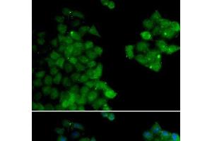 Immunofluorescence analysis of HeLa cells using PSMB10 Polyclonal Antibody (PSMB10 antibody)