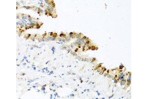 Immunohistochemistry of paraffin-embedded Mouse lung using BMP4 Polyclonal Antibody at dilution of 1:100 (40x lens). (BMP4 antibody)