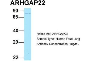 Host: Rabbit  Target Name: ARHGAP22  Sample Tissue: Human Fetal Lung  Antibody Dilution: 1. (ARHGAP22 antibody  (C-Term))