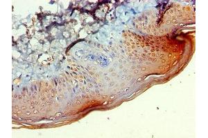 Immunohistochemistry of paraffin-embedded human skin tissue using ABIN7145746 at dilution of 1:100 (BCAT2 antibody  (AA 28-392))