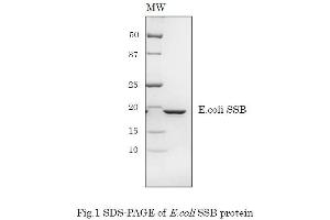 Western Blotting (WB) image for Sjogren Syndrome Antigen B (SSB) (Active) protein (ABIN2452175) (SSB Protein)