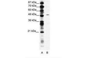 Image no. 1 for anti-Suppressor of Variegation 4-20 Homolog 1 (SUV420H1) (AA 763-812) antibody (ABIN203167) (SUV420H1 antibody  (AA 763-812))