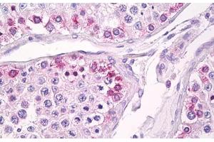 Anti-USP13 antibody IHC staining of human testis. (USP13 antibody  (AA 500-550))