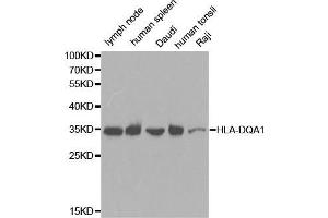 Western blot analysis of extracts of various cell lines, using HLA-DQA1 antibody. (HLA-DQA1 antibody  (AA 24-216))