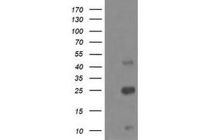 Image no. 3 for anti-Aldehyde Dehydrogenase 1 Family, Member A3 (ALDH1A3) (AA 1-100), (AA 413-512) antibody (ABIN1490537)