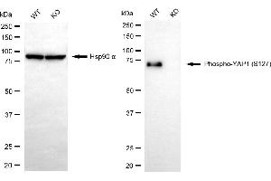 Western blotting analysis using phospho-YAP1 (S127) antibody (ABIN7800882). (Recombinant YAP1 antibody  (pSer127))