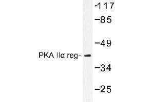 Image no. 1 for anti-Protein Kinase, CAMP-Dependent, Regulatory, Type II, alpha (PRKAR2A) antibody (ABIN272166) (PRKAR2A antibody)
