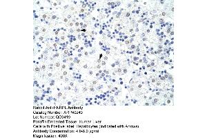 Rabbit Anti-HNRPL Antibody  Paraffin Embedded Tissue: Human Liver Cellular Data: Hepatocytes Antibody Concentration: 4. (HNRNPL antibody  (N-Term))