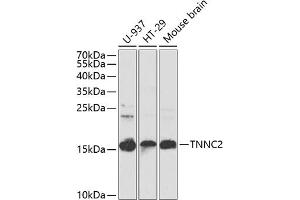 Western blot analysis of extracts of various cell lines, using TNNC2 antibody (ABIN6129604, ABIN6149353, ABIN6149354 and ABIN6223680) at 1:1000 dilution.