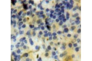 #VALUE! (CXCL10 antibody  (AA 22-98))