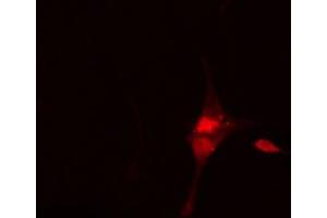 ABIN6269134 staining Hela cells by IF/ICC. (BCR antibody  (N-Term))