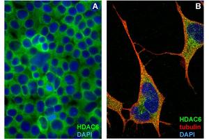 Immunocytochemistry staining of HDAC6 in formaldehyde-fixed and Triton-permeabilized HEK-293T cells (A) and SH-SY5Y cells (B) by mouse monoclonal antibody 159, followed by anti-mouse Alexa Fluor 488 (green), DNA indicated by DAPI (blue). (HDAC6 antibody)