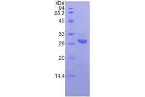 SDS-PAGE analysis of Rat IL22Ra2 Protein. (IL22RA2 Protein)