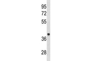 ACAA1 antibody western blot analysis in human 293 lysate. (ACAA1 antibody  (AA 147-176))