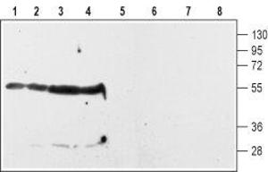 Western blot analysis of rat striatum (lanes 1 and 5) and hippocampus (lanes 2 and 6) membranes and of rat (lanes 3 and 7) and mouse (lanes 4 and 8) whole brain lysates: - 1-4. (Dopamine d2 Receptor antibody  (Extracellular, N-Term))