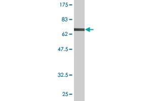 Western Blot detection against Immunogen (74. (Fatty Acid Synthase antibody  (AA 1-439))