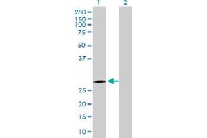 Western Blot analysis of KCTD6 expression in transfected 293T cell line by KCTD6 MaxPab polyclonal antibody. (KCTD6 antibody  (AA 1-237))
