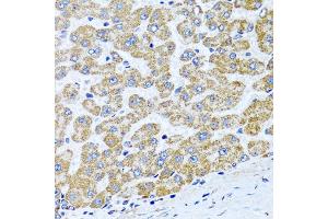 Immunohistochemistry of paraffin-embedded human liver using COL10A1 antibody (ABIN5974149) at dilution of 1/100 (40x lens). (COL10A1 antibody)