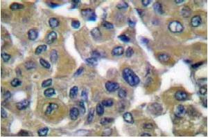 Image no. 1 for anti-Keratin 7 (KRT7) antibody (ABIN265502) (Cytokeratin 7 antibody)