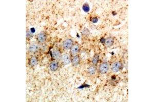 Immunohistochemistry (IHC) image for anti-Ribosomal Protein S3A (RPS3A) antibody (ABIN7308292) (RPS3A antibody)