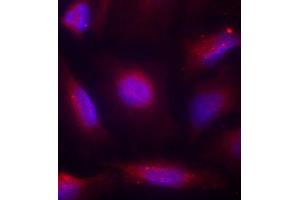 Immunofluorescence staining of methanol-fixed HeLa cells using Phospho-NTRK1-S791 antibody (ABIN2987788). (TRKA antibody  (pSer791))