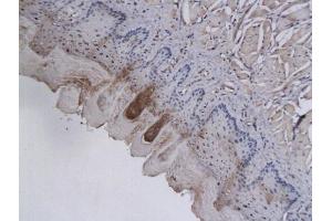 Immunohistochemistry (IHC) image for anti-Aldo-Keto Reductase Family 1, Member B1 (Aldose Reductase) (AKR1B1) (AA 151-250) antibody (ABIN739785)