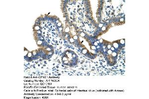 Rabbit Anti-CPNE1 Antibody  Paraffin Embedded Tissue: Human Intestine Cellular Data: Epithelial cells of intestinal villas Antibody Concentration: 4. (CPNE1 antibody  (N-Term))