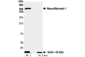 Western Blotting (WB) image for anti-Neurofibromin 1 (NF1) (C-Term) antibody (ABIN7795775) (Recombinant Neurofibromin 1 antibody  (C-Term))
