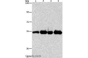 Western blot analysis of Human bladder carcinoma tissue and A172 cell, human fetal brain tissue and hela cell, using PDE4D Polyclonal Antibody at dilution of 1:500 (PDE4D antibody)