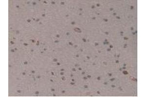 Detection of GM-CSF in Human Brain Tissue using Polyclonal Antibody to Colony Stimulating Factor 2, Granulocyte Macrophage (GM-CSF) (GM-CSF antibody  (AA 18-144))