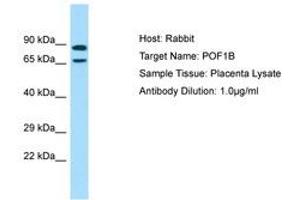 Image no. 1 for anti-Premature Ovarian Failure, 1B (POF1B) (AA 469-518) antibody (ABIN6750034) (POF1B antibody  (AA 469-518))