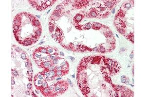 Human, Kidney: Formalin-Fixed Paraffin-Embedded (FFPE). (VARS antibody  (AA 576-625))