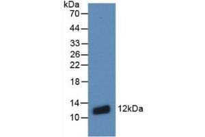 Detection of Recombinant S100A8, Human using Monoclonal Antibody to S100 Calcium Binding Protein A8 (S100A8) (S100A8 antibody  (AA 1-93))